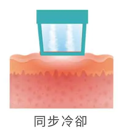 Oligio X 超玩美電波-冷卻模式-同步冷卻