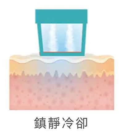 Oligio X 超玩美電波-冷卻模式-鎮靜冷卻