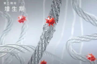 極光美學診所-美國音波2.0-增生期
