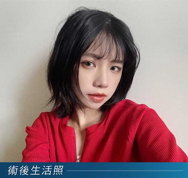 膠原蛋白針黑眼圈術後生活照