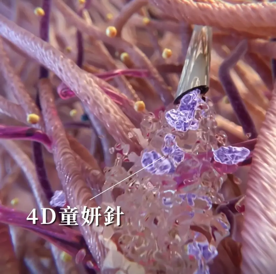 4D童顏針成分原理