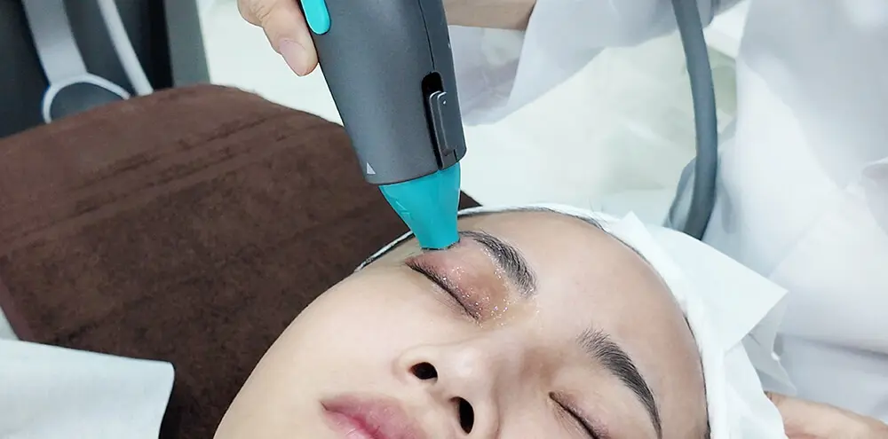 超玩美電波_眼周拉提案例分享