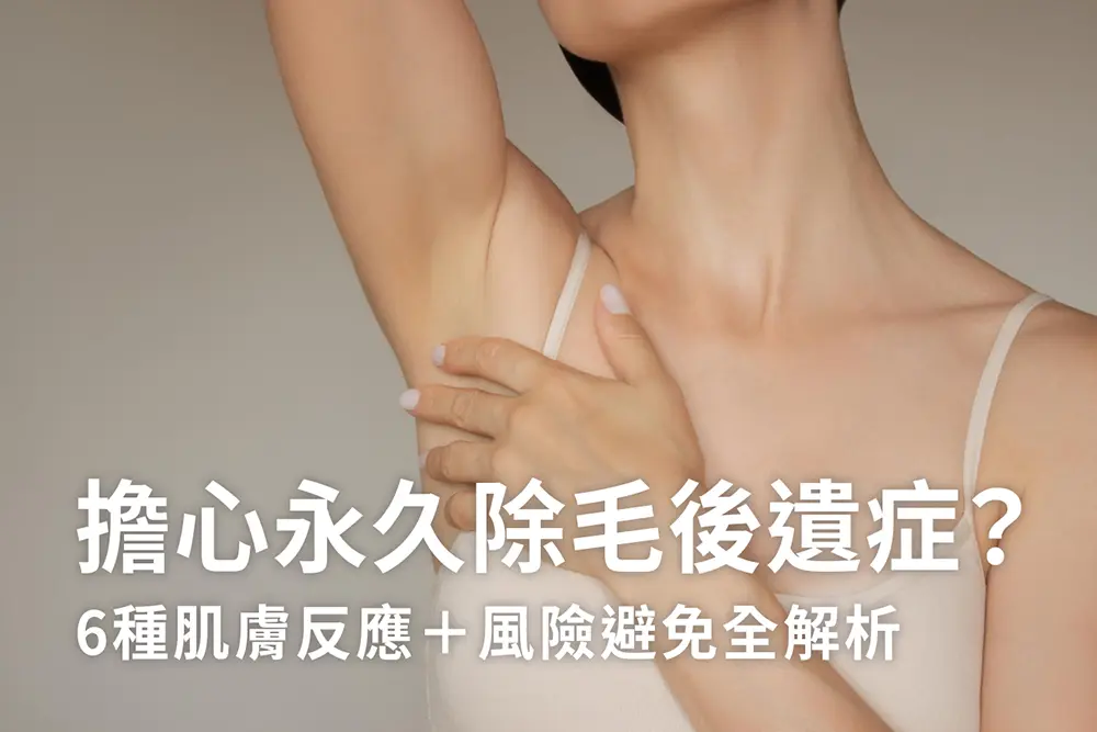 擔心永久除毛後遺症？6種肌膚反應＋風險避免全解析