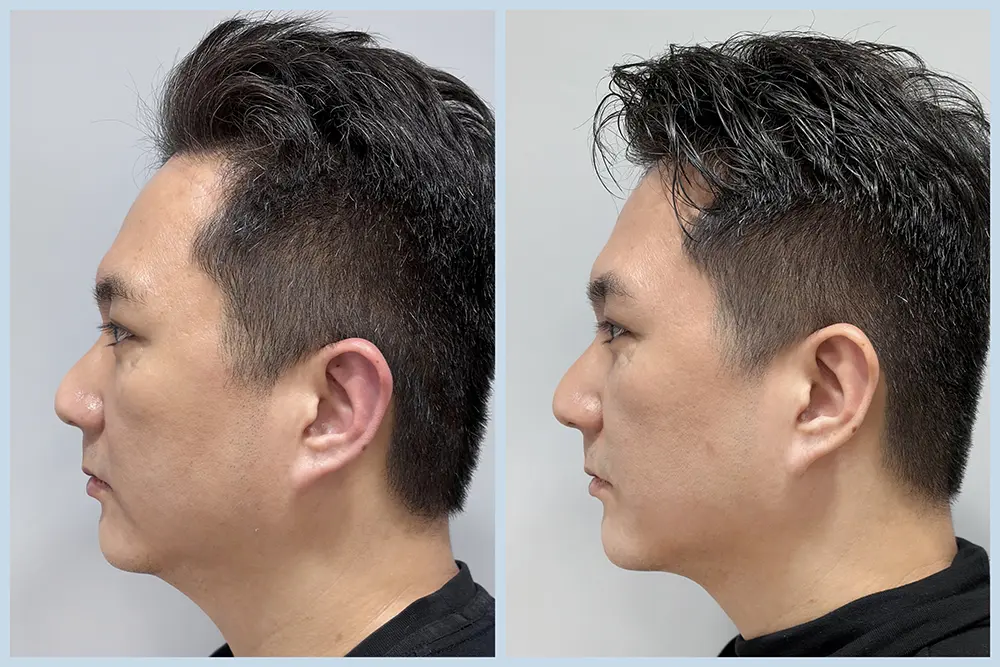 TP12_雙線音波 BA (1)