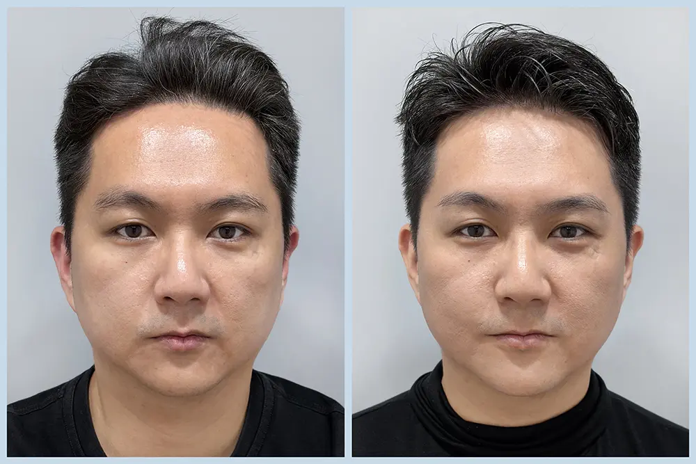 TP12_雙線音波 BA (2)