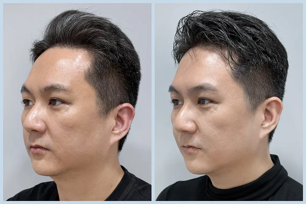 TP12_雙線音波 BA (4)