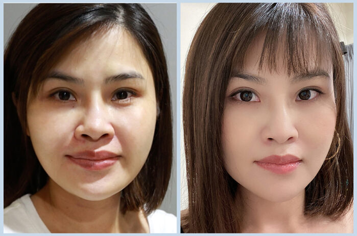 20241104案例首圖-公版