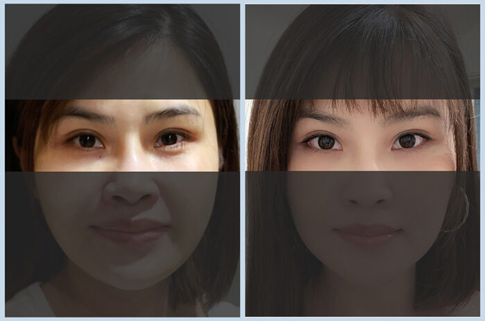 20241104案例首圖-公版