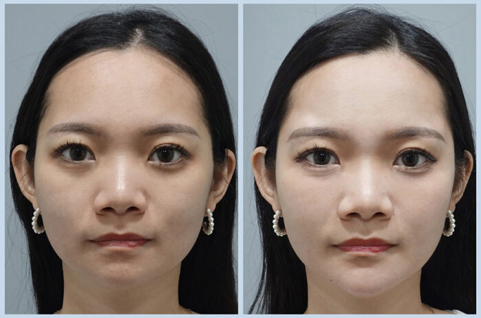 20241104案例首圖-公版