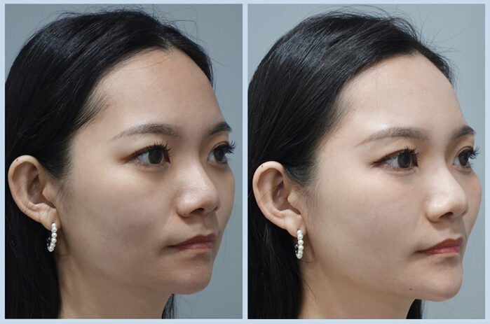 20241104案例首圖-公版