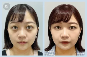 TP08_膠原黑眼圈BA-05