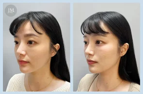 TP10_超玩美電波-分享案例