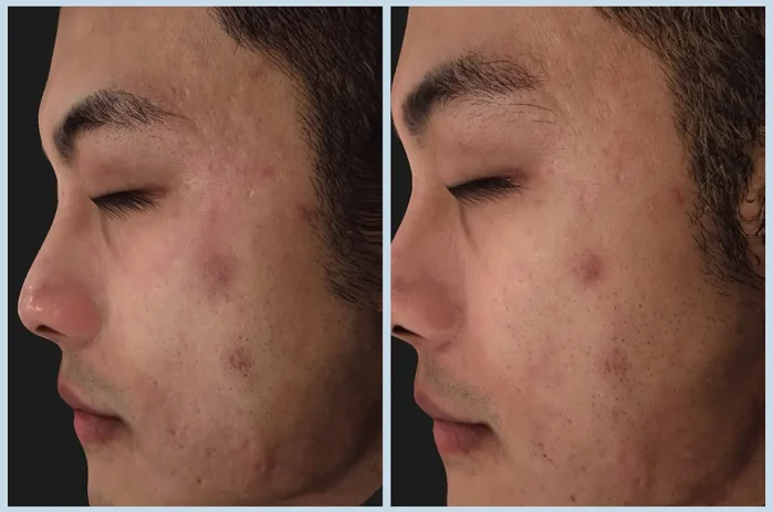 TP13_神比三頻電波 BA (3)