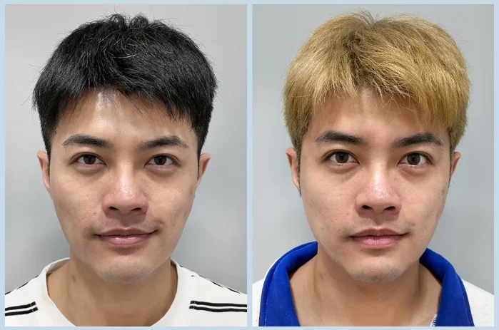 TP13_神比三頻電波 BA (4)