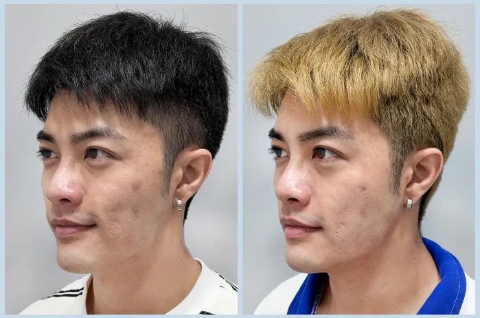 TP13_神比三頻電波 BA (5)