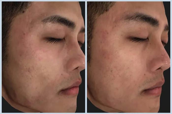 TP13_神比三頻電波 BA (6)