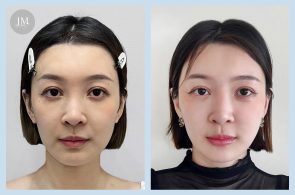 TY02_雙線音波案例分享