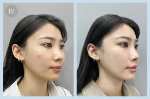 TY08_水光肌BA-首圖