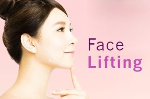 face-lifting