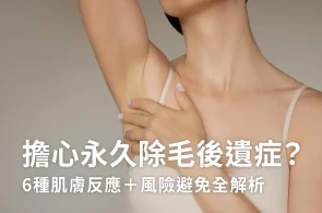 擔心永久除毛後遺症？6種肌膚反應＋風險避免全解析